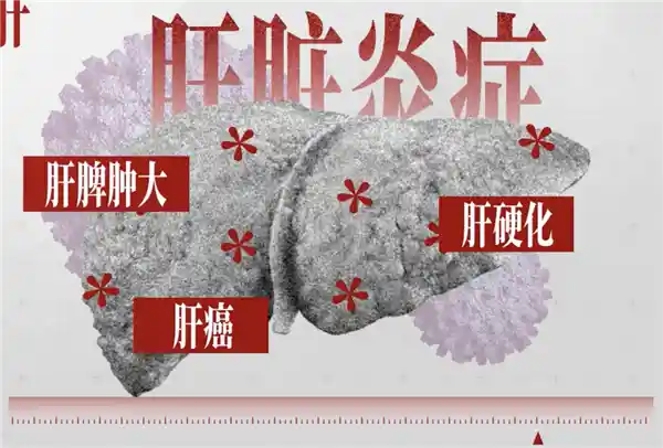 疫苗背后的代际战争：一场改变中国命运的公共卫生革命